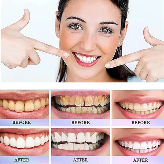 Oralhoe - Nicotinamide Dazzle White Toothpaste